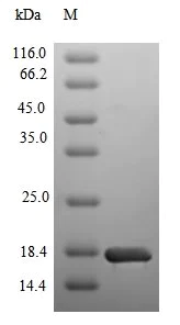 SDS-PAGE - Recombinant Human SGLT2 protein (Tagged) (AB236175)