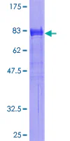SDS-PAGE - Recombinant Human SH2B1/PSM protein (GST tag N-Terminus) (AB161849)