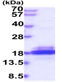 SDS-PAGE - Recombinant Human SH2D1B protein (His tag) (AB226887)