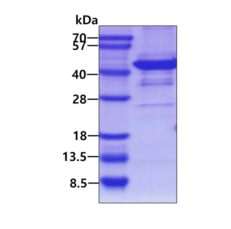SDS-PAGE - Recombinant Human SH3GL2 protein (His tag N-Terminus) (AB124551)