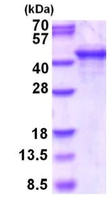 SDS-PAGE - Recombinant Human SH3GL3 protein (His tag) (AB202261)