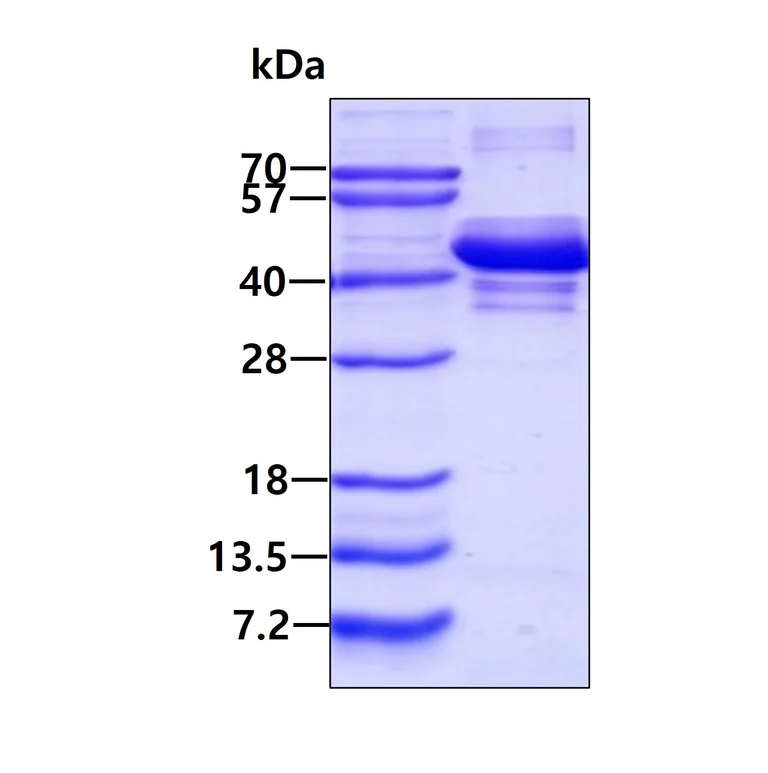 SDS-PAGE - Recombinant Human SH3GL3 protein (His tag) (AB202261)
