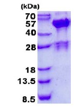 SDS-PAGE - Recombinant Human SH3GLB2 protein (AB137174), expandable thumbnail
