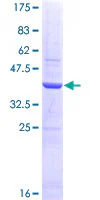 SDS-PAGE - Recombinant Human SHBG protein (GST tag N-Terminus) (AB159505)