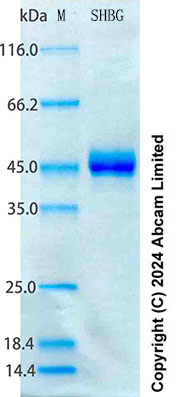 SDS-PAGE - Recombinant Human SHBG Protein Standard (His tag) (AB316653), expandable thumbnail