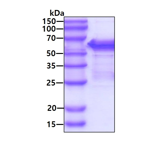 SDS-PAGE - Recombinant Human SHC protein (AB109851)