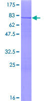 SDS-PAGE - Recombinant Human SHK protein (AB161754)