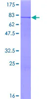 SDS-PAGE - Recombinant Human SHK protein (GST tag N-Terminus) (AB161754)