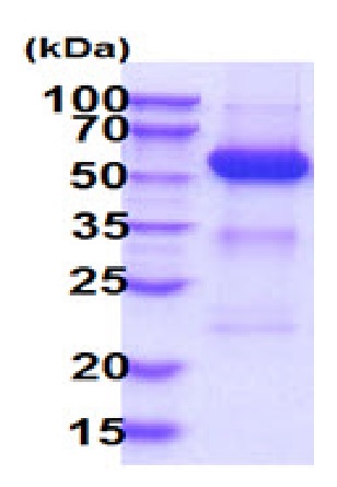 SDS-PAGE - Recombinant Human SHP2 protein (His tag) (AB227396), expandable thumbnail