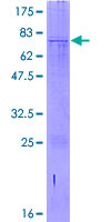 SDS-PAGE - Recombinant Human SI-CLP protein (AB163948), expandable thumbnail