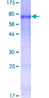Recombinant Human SIAE protein