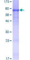 SDS-PAGE - Recombinant Human SIAE protein (GST tag N-Terminus) (AB162734)