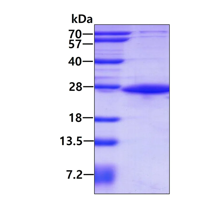SDS-PAGE - Recombinant Human SIAH1 protein (His tag N-Terminus) (AB131709)