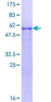 Recombinant Human Siah2 protein