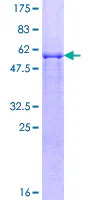 SDS-PAGE - Recombinant Human Siah2 protein (GST tag N-Terminus) (AB132352)