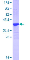 SDS-PAGE - Recombinant Human Sialidase-3 protein (AB161170), expandable thumbnail