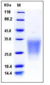SDS-PAGE - Recombinant Human SIGIRR protein (His tag) (AB276467)