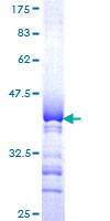 SDS-PAGE - Recombinant Human SIGLEC10 protein (AB164780), expandable thumbnail