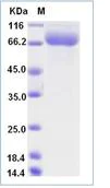 SDS-PAGE - Recombinant Human SIGLEC10 protein (His tag) (AB276737)