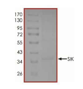SDS-PAGE - Recombinant human SIK1 protein (Active) (AB268969), expandable thumbnail