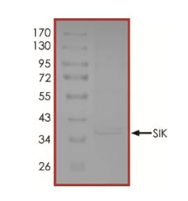SDS-PAGE - Recombinant human SIK1 protein (Active) (AB268969)