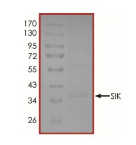SDS-PAGE - Recombinant human SIK1 protein (Active) (His tag N-Terminus) (AB268969)