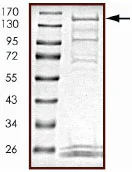 SDS-PAGE - Recombinant human SIK2 protein (GST tag N-Terminus) (AB89856)