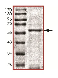 SDS-PAGE - Recombinant human SIK3 protein (AB136351)