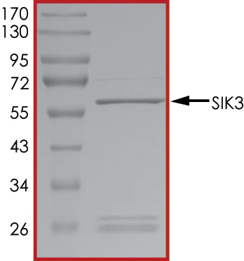 SDS-PAGE - Recombinant human SIK3 protein (AB136351)