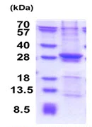 SDS-PAGE - Recombinant Human SIKE1 protein (His tag N-Terminus) (AB177720)