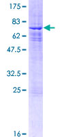 Recombinant Human Sin3b protein
