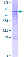 SDS-PAGE - Recombinant Human Sin3b protein (AB161600)