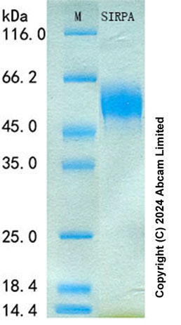SDS-PAGE - Recombinant Human SIRP alpha Protein Standard (His tag) (AB322096), expandable thumbnail