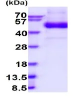 SDS-PAGE - Recombinant Human SIRPB1 protein (His tag C-Terminus) (AB235876)