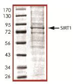 SDS-PAGE - Recombinant human SIRT1 protein (AB101130)