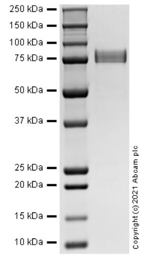 SDS-PAGE - Recombinant Human SIRT1 protein (AB287914)