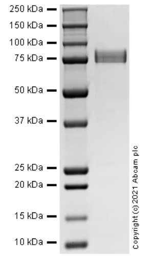 SDS-PAGE - Recombinant Human SIRT1 protein (AB287914)