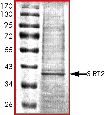 SDS-PAGE - Recombinant human SIRT2 protein (His tag N-Terminus) (AB101132)