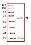 SDS-PAGE - Recombinant Human SIRT3 protein (Tagged) (AB125586)