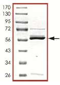 SDS-PAGE - Recombinant Human SIRT5 protein (AB101133)