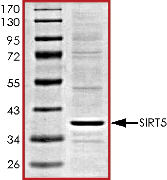 SDS-PAGE - Recombinant human SIRT5 protein (AB101134)