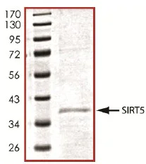 SDS-PAGE - Recombinant human SIRT5 protein (AB101134)