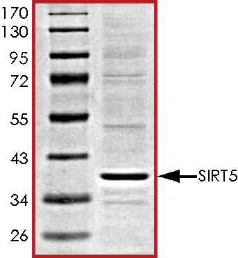 SDS-PAGE - Recombinant human SIRT5 protein (His tag N-Terminus) (AB101134)