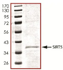 SDS-PAGE - Recombinant human SIRT5 protein (His tag N-Terminus) (AB101134)