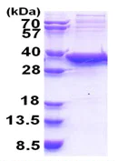 SDS-PAGE - Recombinant Human SIRT5 protein (His tag N-Terminus) (AB176062)