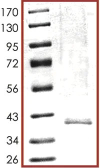 SDS-PAGE - Recombinant human SIRT6 protein (AB104030)