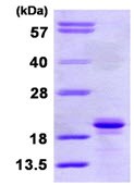 SDS-PAGE - Recombinant Human SIT protein (AB113580)