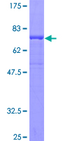 SDS-PAGE - Recombinant Human SKIP protein (AB132744)