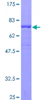 SDS-PAGE - Recombinant Human SKIP protein (GST tag N-Terminus) (AB132744)