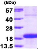SDS-PAGE - Recombinant Human Skp1 protein (AB90687)